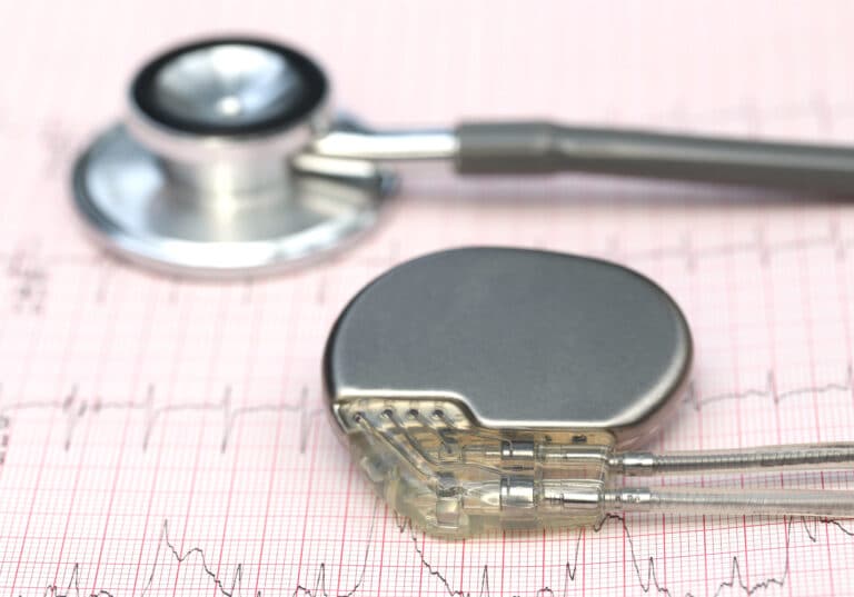 Pacemaker And Stethoscope Resting On An Electrocardiogram