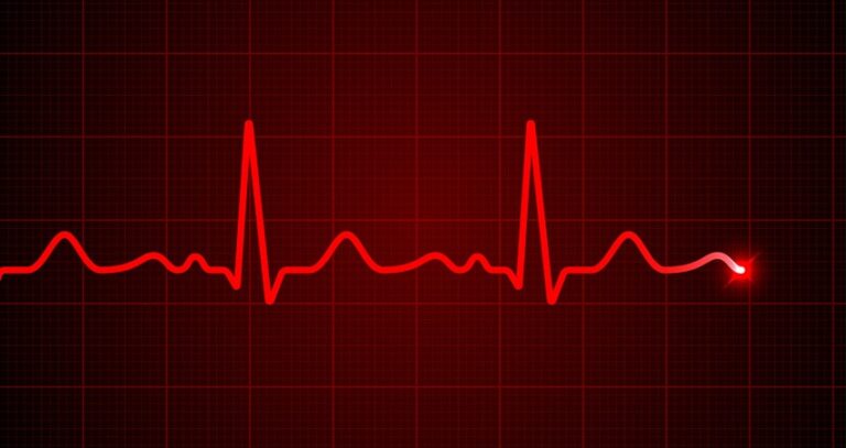 forord Smag Tidlig 7 AFib Triggers You Might Not Know About | Heart Rhythm Consultants